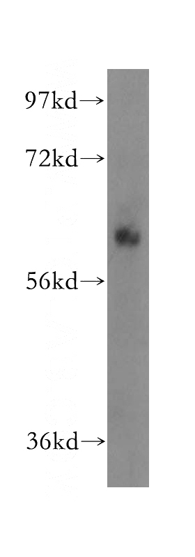 mouse liver tissue were subjected to SDS PAGE followed by western blot with Catalog No:113346(OMA1 antibody) at dilution of 1:500