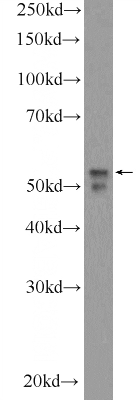 Y79 cells were subjected to SDS PAGE followed by western blot with Catalog No:113126(NEUROD4 Antibody) at dilution of 1:1000