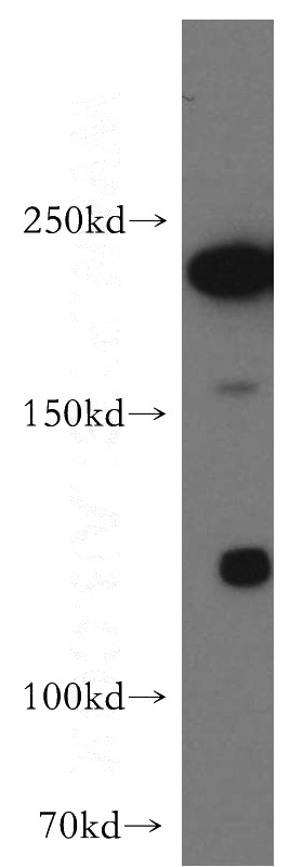 HEK-293 cells were subjected to SDS PAGE followed by western blot with Catalog No:115361(SLK antibody) at dilution of 1:2000