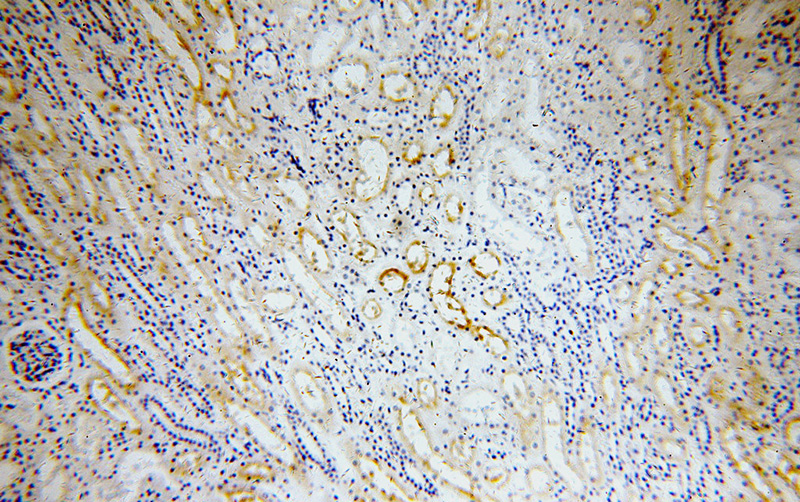 Immunohistochemical of paraffin-embedded human kidney using Catalog No:110403(ERBB4 antibody) at dilution of 1:100 (under 10x lens)
