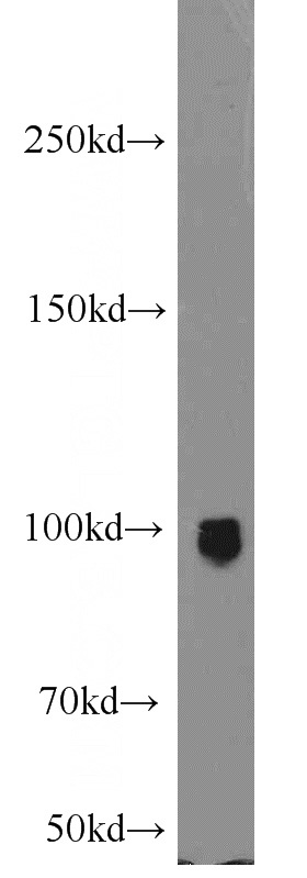 PC-3 cells were subjected to SDS PAGE followed by western blot with Catalog No:110274(ELF1 antibody) at dilution of 1:2000