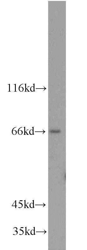 mouse brain tissue were subjected to SDS PAGE followed by western blot with Catalog No:107698(ACSL5 antibody) at dilution of 1:1200