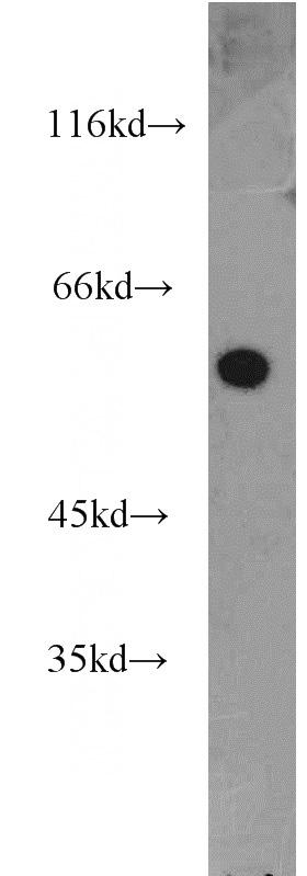 HepG2 cells were subjected to SDS PAGE followed by western blot with Catalog No:113244(NMD3 antibody) at dilution of 1:1000