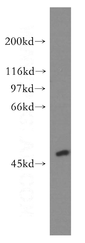 human brain tissue were subjected to SDS PAGE followed by western blot with Catalog No:107745(ACOT2 antibody) at dilution of 1:500