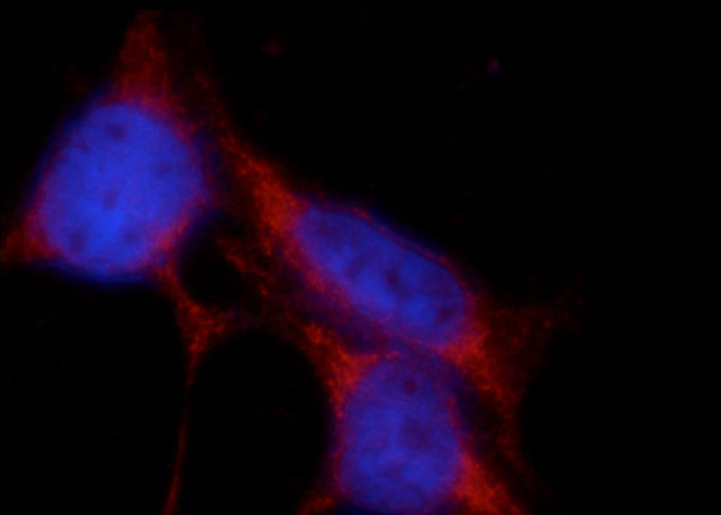 Immunofluorescent analysis of HEK-293 cells using Catalog No:115274(SHISA4 Antibody) at dilution of 1:25 and Rhodamine-Goat anti-Rabbit IgG