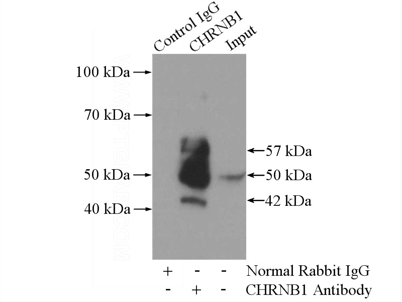 IP Result of anti-CHRNB1 (IP:Catalog No:109284, 4ug; Detection:Catalog No:109284 1:300) with mouse liver tissue lysate 4000ug.