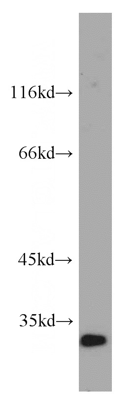 Jurkat cells were subjected to SDS PAGE followed by western blot with Catalog No:110445(F12 antibody) at dilution of 1:500