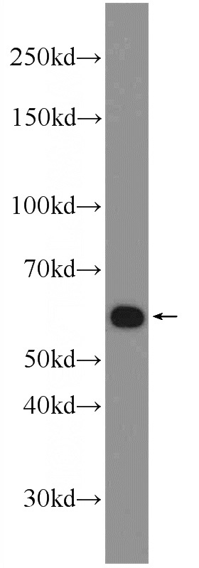 HeLa cells were subjected to SDS PAGE followed by western blot with Catalog No:116959(ZNF211 Antibody) at dilution of 1:600