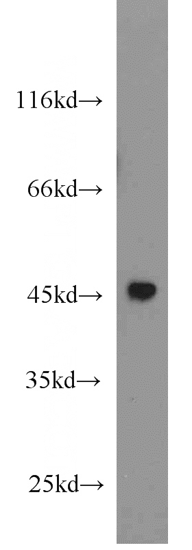 HeLa cells were subjected to SDS PAGE followed by western blot with Catalog No:117196(BMP2 antibody) at dilution of 1:1000
