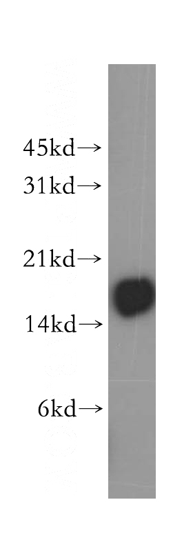 Jurkat cells were subjected to SDS PAGE followed by western blot with Catalog No:109015(CD247 antibody) at dilution of 1:500