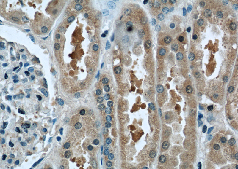 Immunohistochemistry of paraffin-embedded human kidney tissue slide using Catalog No:108717(C2orf67 Antibody) at dilution of 1:50 (under 40x lens)