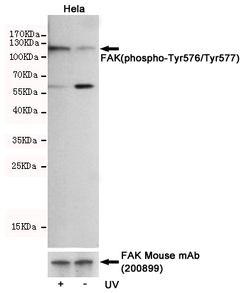 Western blot detection of FAK(phospho-Tyr576/Tyr577) in Hela cells untreated or UV-treated, using FAK(phospho-Tyr576/Tyr577) Rabbit pAb (dilution 1:1000, upper) or FAK Mouse mAb (200899 dilution 1:500, lower).Predicted band size:125kDa.Observed band size:125kDa.