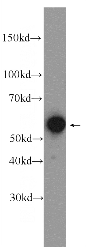 HEK-293 cells were subjected to SDS PAGE followed by western blot with Catalog No:111229(GTF2E1 Antibody) at dilution of 1:3000