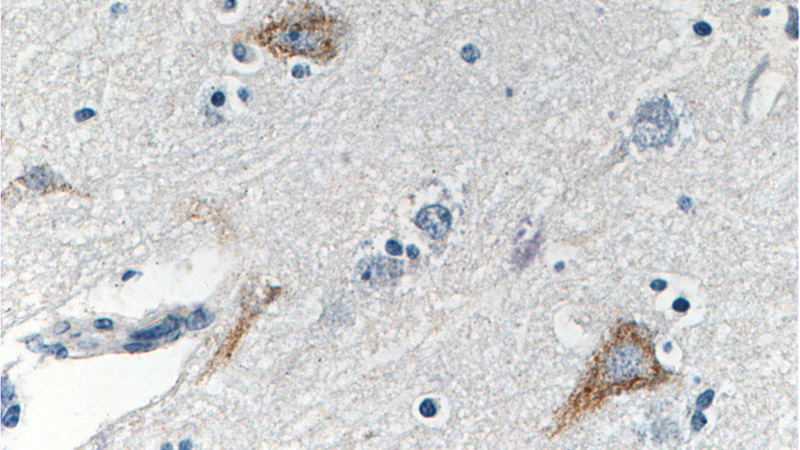 Immunohistochemistry of paraffin-embedded human brain tissue slide using Catalog No:113127(NFASC Antibody) at dilution of 1:200 (under 40x lens).