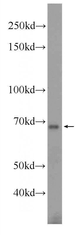 mouse testis tissue were subjected to SDS PAGE followed by western blot with Catalog No:116324(TRIM69 Antibody) at dilution of 1:600