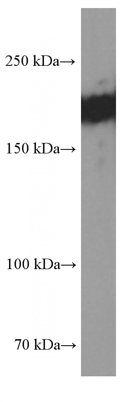 human heart tissue were subjected to SDS PAGE followed by western blot with Catalog No:107530(SETDB1 Antibody) at dilution of 1:8000