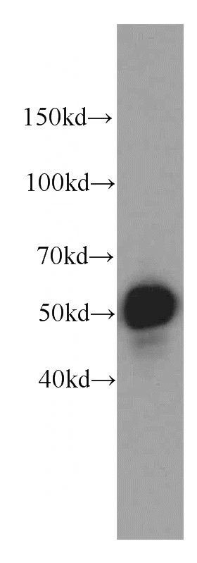 HeLa cells were subjected to SDS PAGE followed by western blot with Catalog No:117013(ZNF622 antibody) at dilution of 1:500