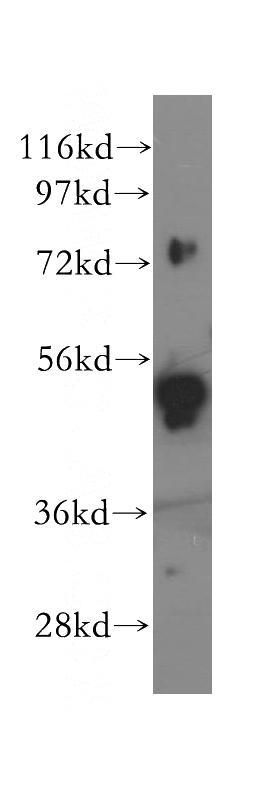 NIH/3T3 cells were subjected to SDS PAGE followed by western blot with Catalog No:115482(SNX4 antibody) at dilution of 1:300