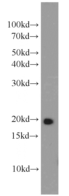 mouse brain tissue were subjected to SDS PAGE followed by western blot with Catalog No:114550(RAP2B antibody) at dilution of 1:500