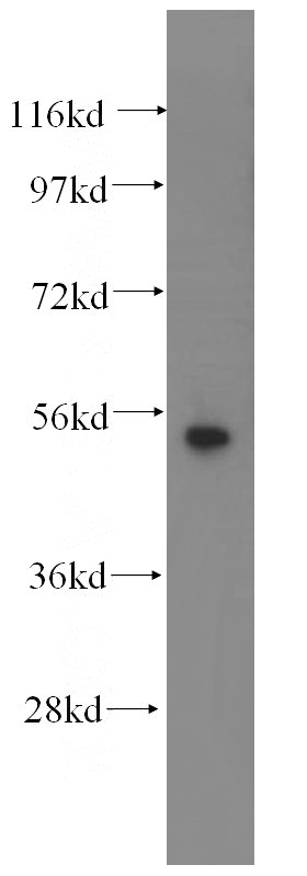mouse liver tissue were subjected to SDS PAGE followed by western blot with Catalog No:109812(KRT7-specific antibody) at dilution of 1:500