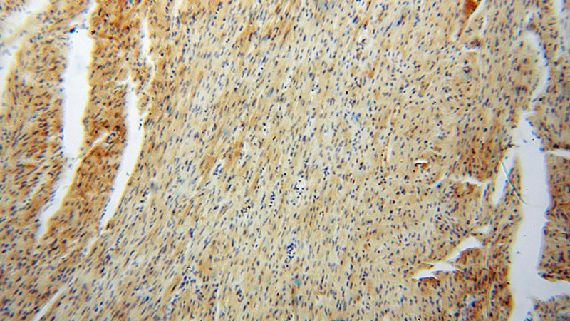 Immunohistochemical of paraffin-embedded human heart using Catalog No:110844(GALM antibody) at dilution of 1:50 (under 10x lens)
