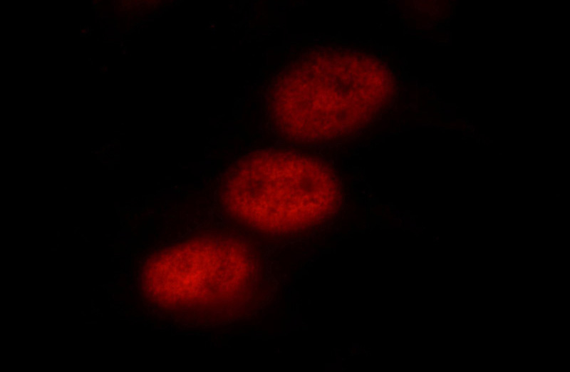 Immunofluorescent analysis of HepG2 cells using Catalog No:116069(TLE3 Antibody) at dilution of 1:25 and Rhodamine-Goat anti-Rabbit IgG