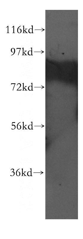 HEK-293 cells were subjected to SDS PAGE followed by western blot with Catalog No:108896(CBFA2T2 antibody) at dilution of 1:300