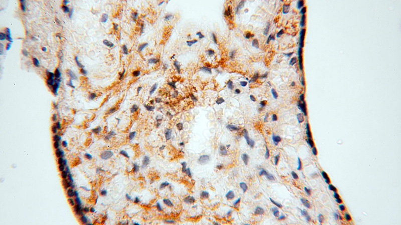 Immunohistochemical of paraffin-embedded human placenta using Catalog No:113242(NLRP2 antibody) at dilution of 1:50 (under 40x lens)