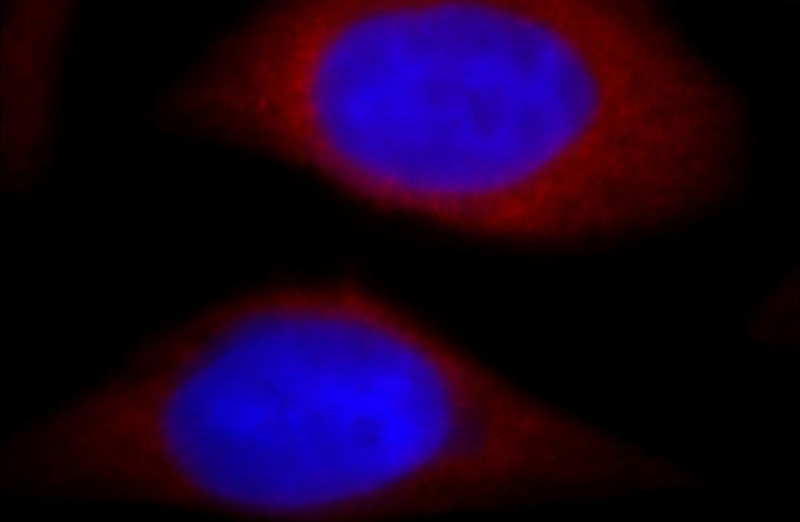 Immunofluorescent analysis of Hela cells, using PIH1D1 antibody Catalog No:113900 at 1:25 dilution and Rhodamine-labeled goat anti-rabbit IgG (red). Blue pseudocolor = DAPI (fluorescent DNA dye).
