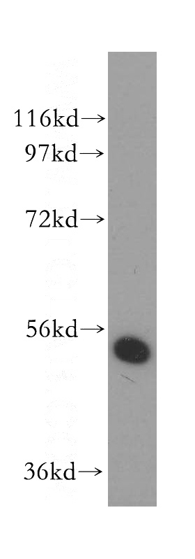 HeLa cells were subjected to SDS PAGE followed by western blot with Catalog No:107785(ADSL antibody) at dilution of 1:400