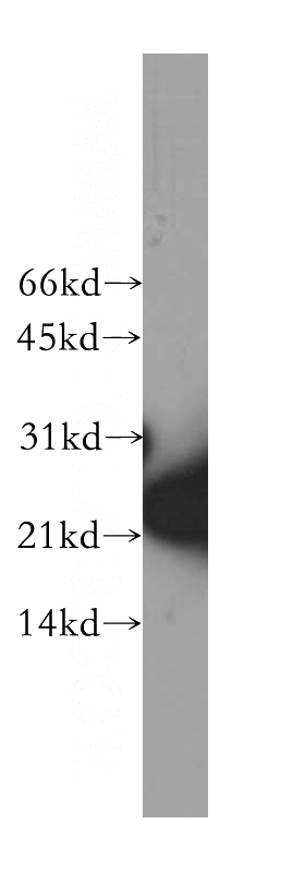 human brain tissue were subjected to SDS PAGE followed by western blot with Catalog No:115289(SKP1 antibody) at dilution of 1:500