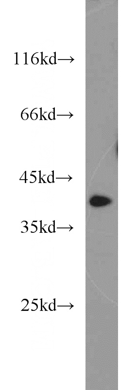 human blood tissue were subjected to SDS PAGE followed by western blot with Catalog No:108032(APOL1 antibody) at dilution of 1:1000