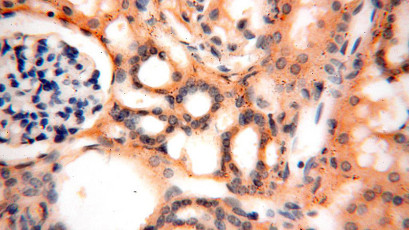 Immunohistochemical of paraffin-embedded human kidney using Catalog No:115404(SMU1 antibody) at dilution of 1:100 (under 40x lens)