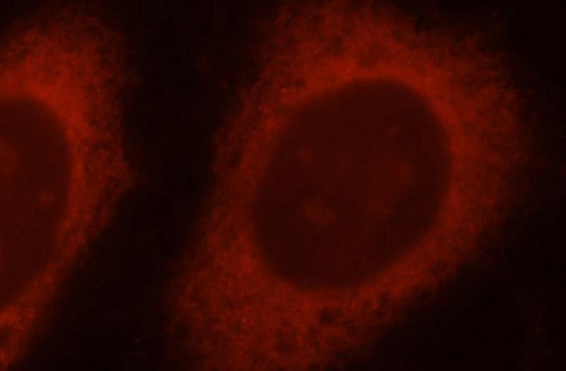 Immunofluorescent analysis of Hela cells, using Catalog No:112474 and Rhodamine-labeled goat anti-rabbit IgG (red).