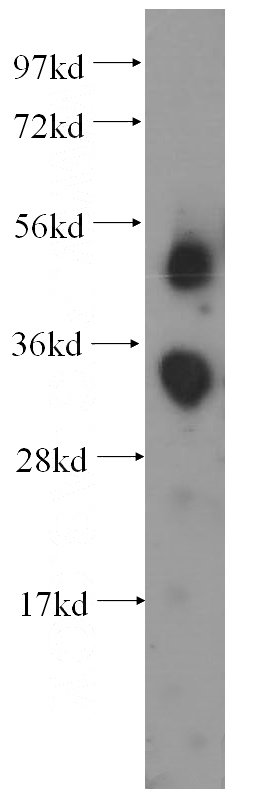 human placenta tissue were subjected to SDS PAGE followed by western blot with Catalog No:110570(FCN3 antibody) at dilution of 1:500