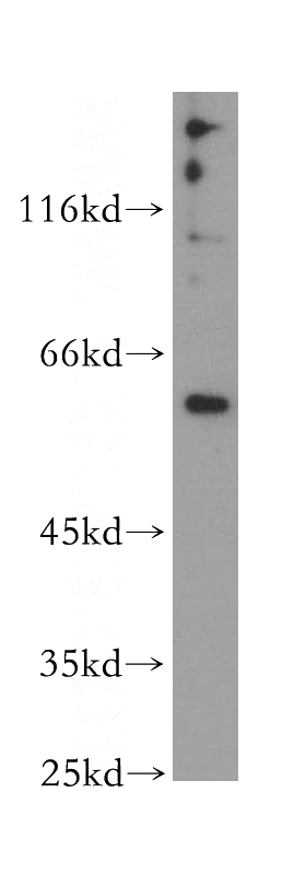 HeLa cells were subjected to SDS PAGE followed by western blot with Catalog No:116500(PEO1 antibody) at dilution of 1:800