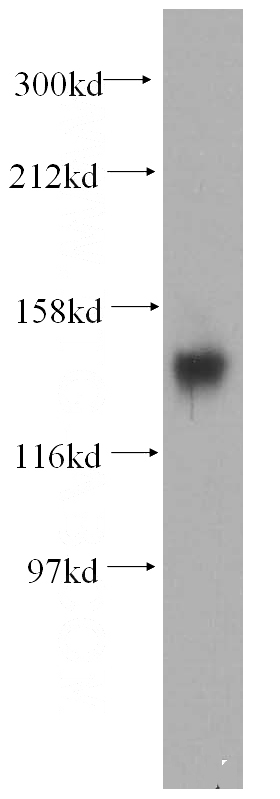 mouse brain tissue were subjected to SDS PAGE followed by western blot with Catalog No:109912(DGKH antibody) at dilution of 1:300