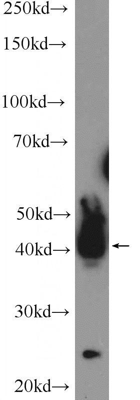 human testis tissue were subjected to SDS PAGE followed by western blot with Catalog No:117069(ATXN3L Antibody) at dilution of 1:600