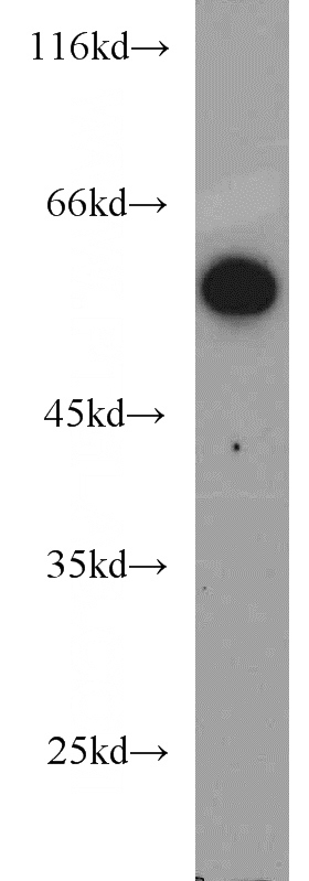 HeLa cells were subjected to SDS PAGE followed by western blot with Catalog No:107962(ALDH1B1 antibody) at dilution of 1:1000