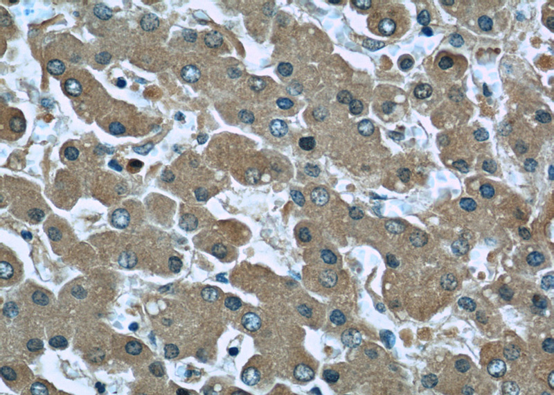 Immunohistochemistry of paraffin-embedded human liver slide using Catalog No:107437(ORM1 Antibody) at dilution of 1:50