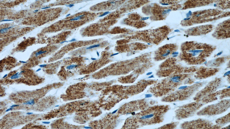 Immunohistochemical of paraffin-embedded human heart using Catalog No:113435(ATP5O antibody) at dilution of 1:50 (under 40x lens)