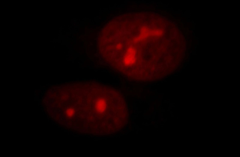 Immunofluorescent analysis of Hela cells, using NSUN2 antibody Catalog No:113388 at 1:25 dilution and Rhodamine-labeled goat anti-rabbit IgG (red).