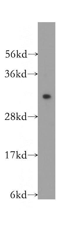 human brain tissue were subjected to SDS PAGE followed by western blot with Catalog No:116293(APRIL,TNFSF13 antibody) at dilution of 1:300