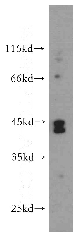 L02 cells were subjected to SDS PAGE followed by western blot with Catalog No:113178(NHLRC1 antibody) at dilution of 1:400