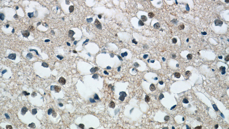 Immunohistochemistry of paraffin-embedded human brain tissue slide using Catalog No:112897(MUM1L1 Antibody) at dilution of 1:50 (under 40x lens)