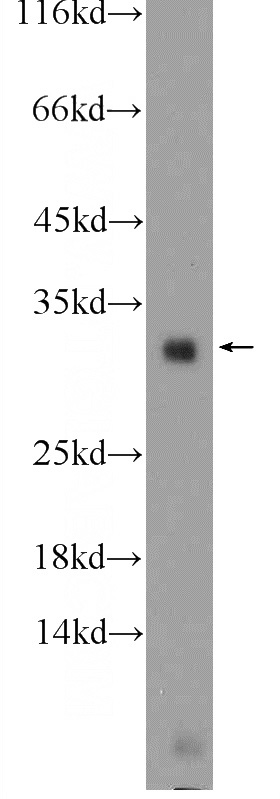 mouse liver tissue were subjected to SDS PAGE followed by western blot with Catalog No:116227(TRA2B Antibody) at dilution of 1:1000