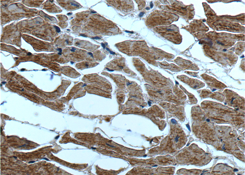 Immunohistochemistry of paraffin-embedded human heart tissue slide using Catalog No:107603(IL1RL1 Antibody) at dilution of 1:200 (under 40x lens).