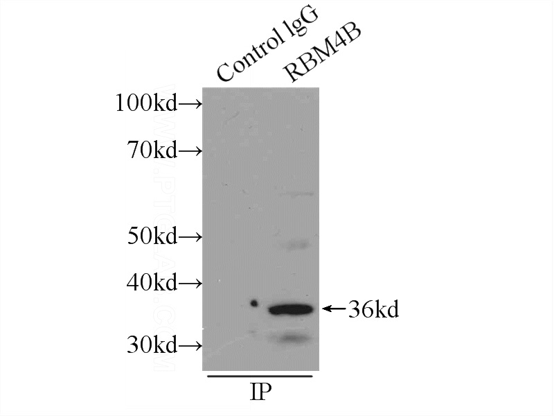 IP Result of anti-RBM4B (IP:Catalog No:114617, 3ug; Detection:Catalog No:114617 1:300) with HEK-293 cells lysate 1000ug.