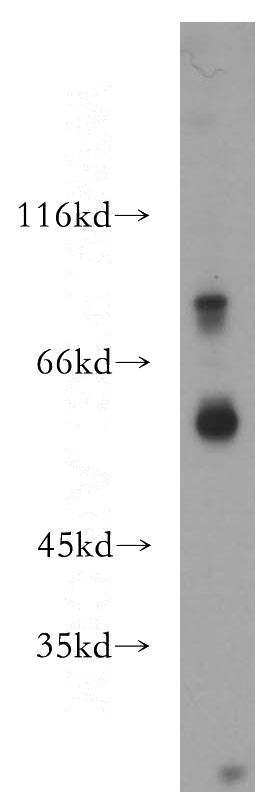 HeLa cells were subjected to SDS PAGE followed by western blot with Catalog No:113542(P2RX4 antibody) at dilution of 1:300