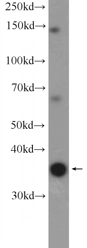 HeLa cells were subjected to SDS PAGE followed by western blot with Catalog No:110576(FAM164C Antibody) at dilution of 1:1000